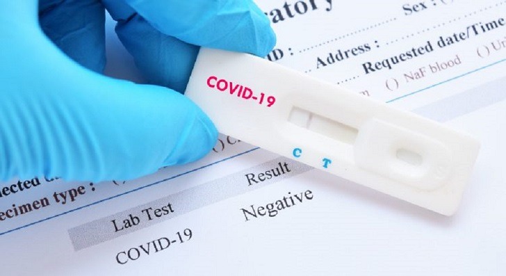 EE.UU. autoriza prueba para diagnosticar en unos 45 minutos COVID-19