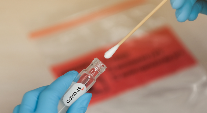 Diógenes Chávez: «Ya tenemos 4,000 kits se reactivos para hacer pruebas PCR en Cortés»