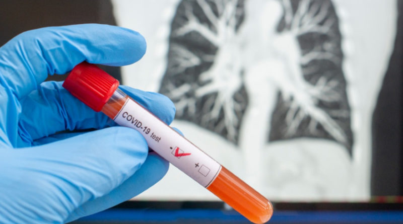 Enfermera muere por covid-19 en el IHSS de SPS Enfermera muere por covid-19 en el IHSS de SPS