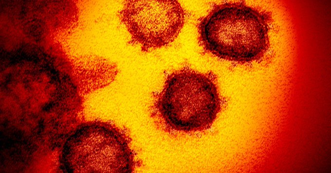 Israel desarrolló un anticuerpo para neutralizar el coronavirus Israel desarrolló un anticuerpo para neutralizar el coronavirus