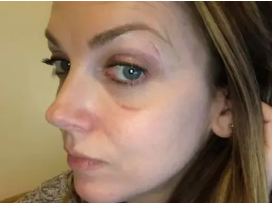 “No teníamos lo que quería y me golpeó”: con el rostro ensangrentado una empleada en California reveló la agresión de una clienta