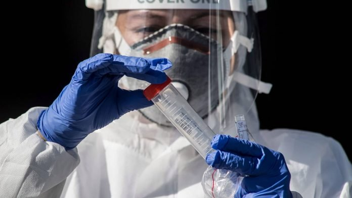 Johnson & Johnson anunció que producirá 1.000 millones de vacunas para el coronavirus Johnson & Johnson anunció que producirá 1.000 millones de vacunas para el coronavirus