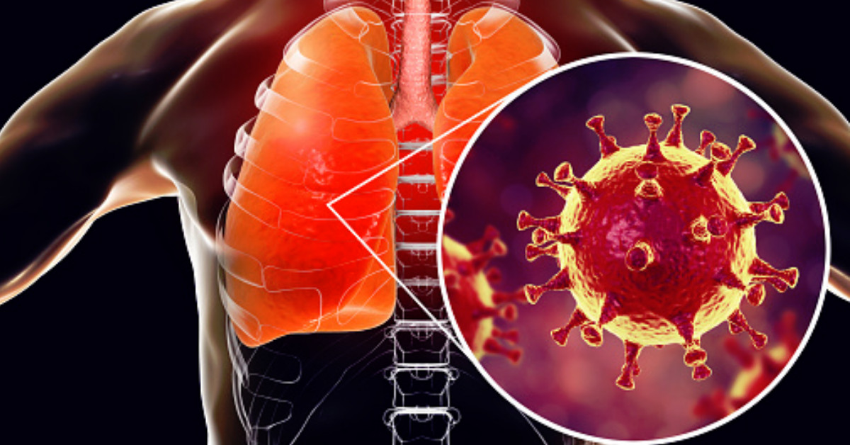 Cómo limpiar y fortalecer tus pulmones ante el Covid-19 Cómo limpiar y fortalecer tus pulmones ante el Covid-19