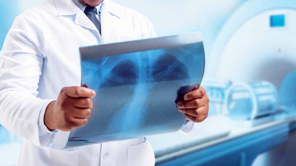 Confirman cinco técnicos en radiología con COVID-19 Confirman cinco técnicos en radiología con COVID-19