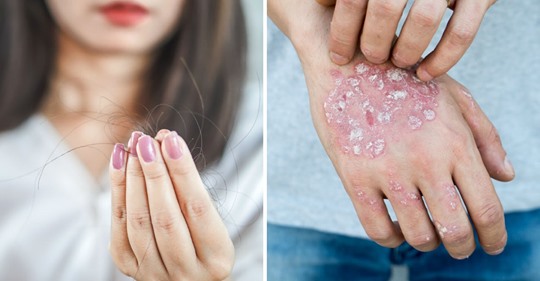 Así se ven los síntomas de estrés cuando tu cuerpo ya no lo soporta más