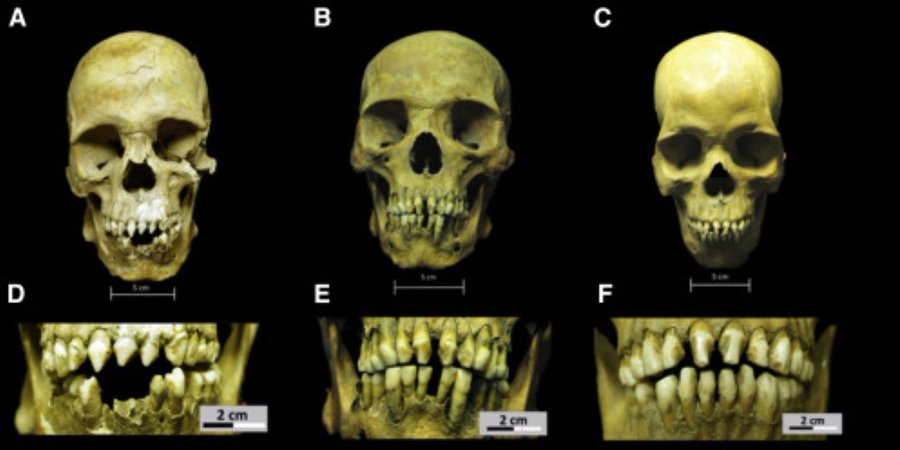 Los cráneos que contaron la oscura verdad enterrada de los esclavos africanos en México