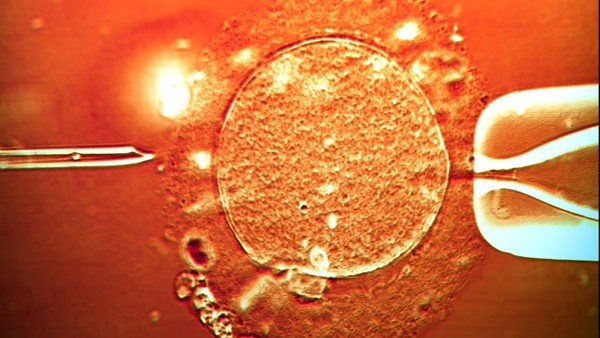 Descubren que los óvulos “eligen” pareja, y son selectivos Descubren que los óvulos “eligen” pareja, y son selectivos