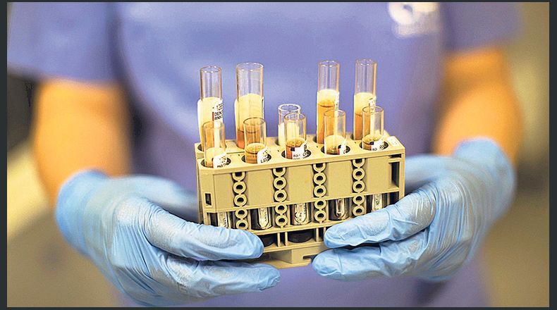 Estudio vincula grupo sanguíneo con gravedad de covid-19 Estudio vincula grupo sanguíneo con gravedad de covid-19