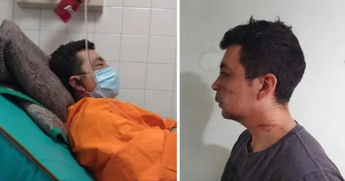 Golpean y le queman su casa a enfermero que se curó de coronavirus