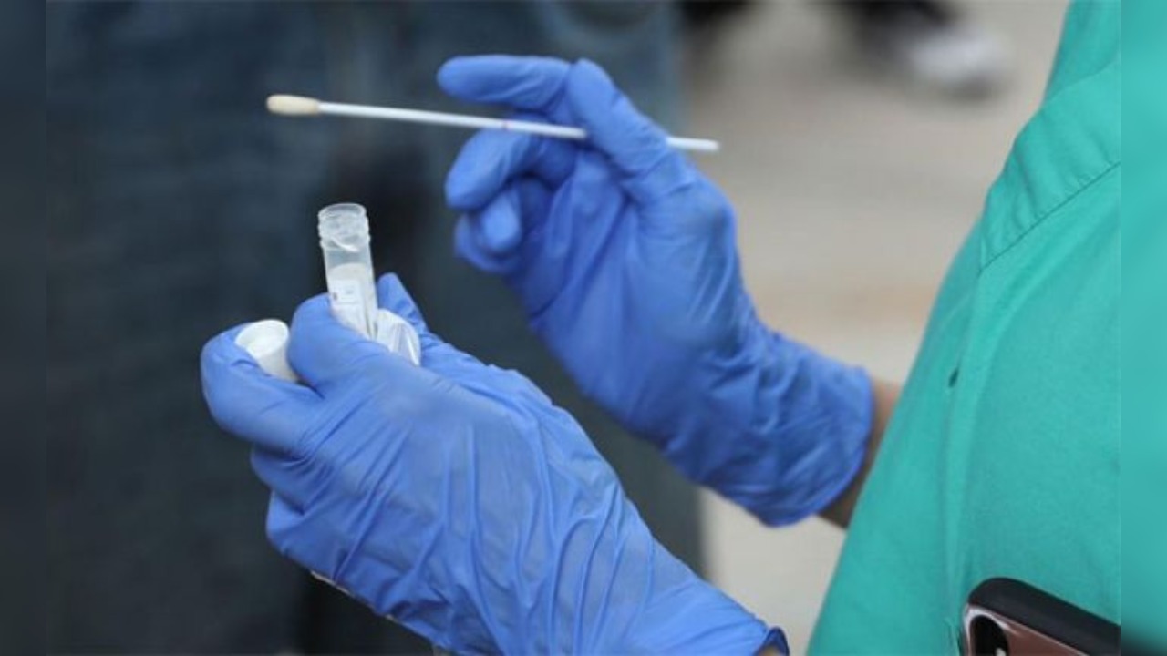 Viceministro de Salud: «En este momento no tenemos mora en el procesamiento de pruebas»