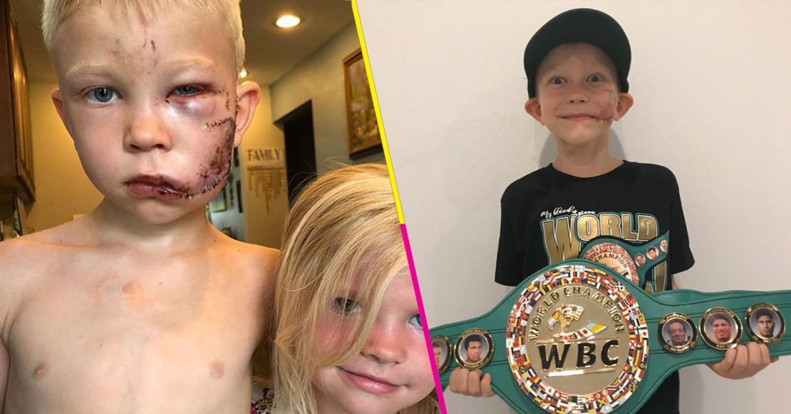 Bridger Walker es nombrado el hombre más valiente de la tierra por el consejo mundial de boxeo