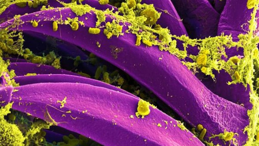 La peste bubónica está de vuelta en la Mongolia Interior de China