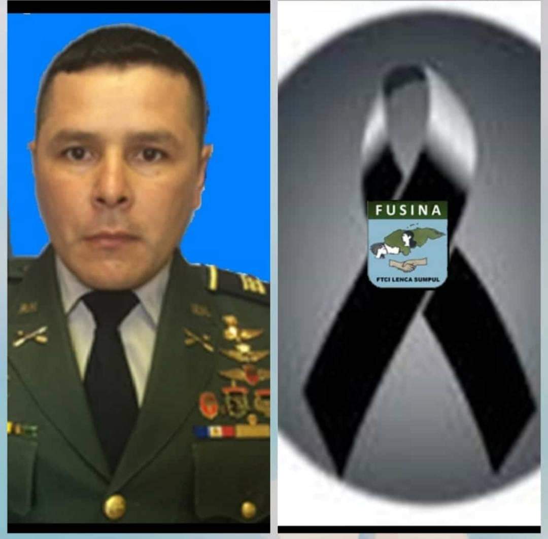 ¡Por neumonía! Muere capitán de las FFAA