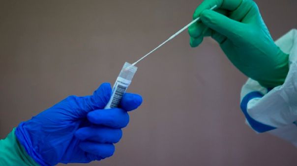 Los «Test de Antígenos» son más eficientes y más baratos, asegura experto Los «Test de Antígenos» son más eficientes y más baratos, asegura experto