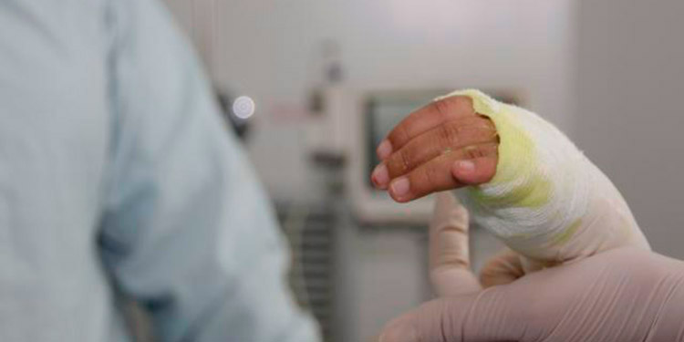 Menor de edad se quema parte de sus dedos por manipular pólvora Menor de edad se quema parte de sus dedos por manipular pólvora