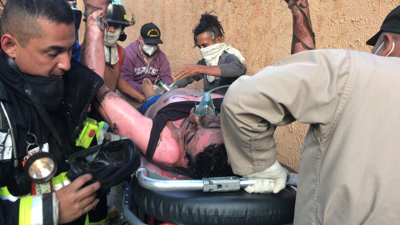 Joven resulta con graves quemaduras tras incendiarse su vivienda en la colonia Kennedy