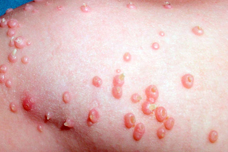 Dra. Etelinda López: “38 millones de personas padecen de enfermedades de transmisión sexual en Latinoamérica”