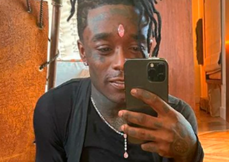 24 millones de dólares incrustados en la frente…