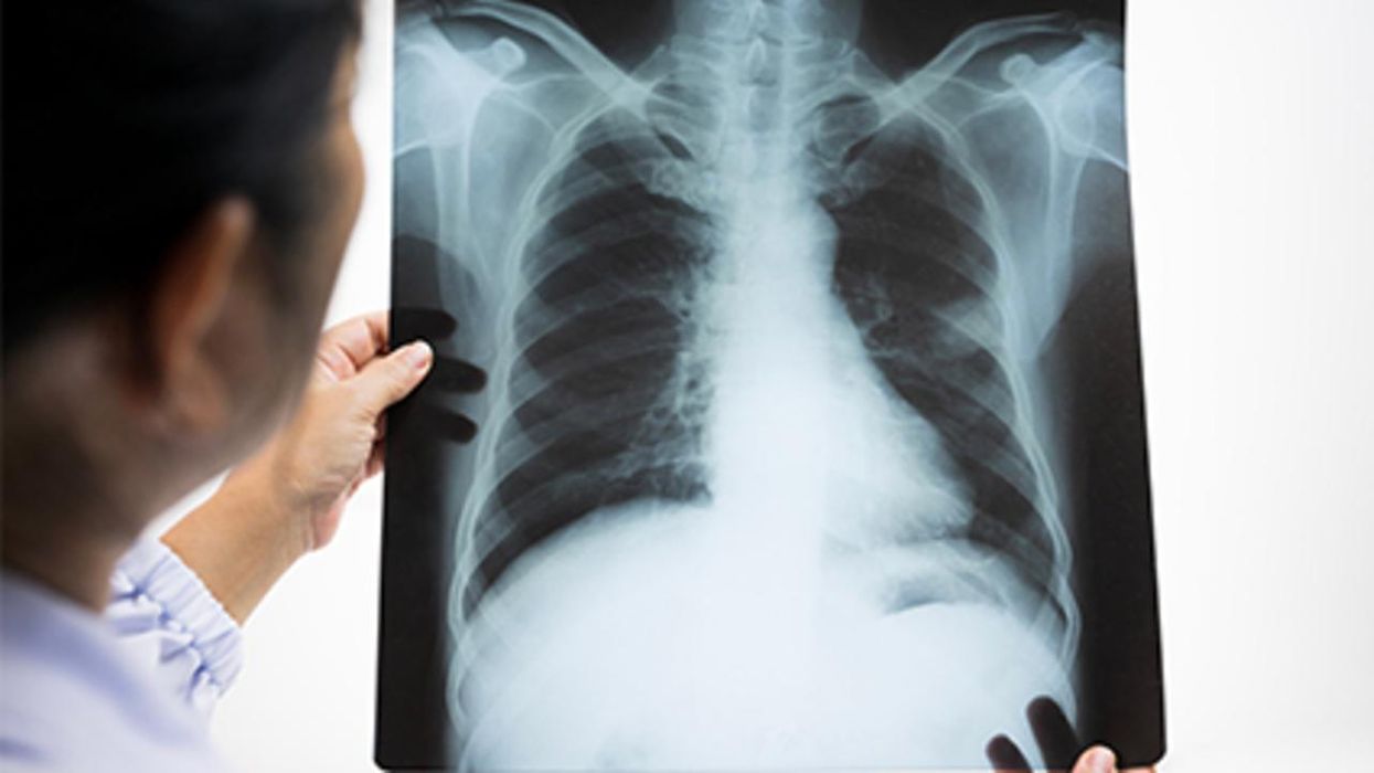 La Covid-19 puede causar más de 50 efectos a largo plazo según estudios