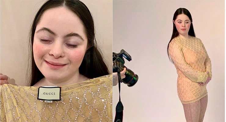 Ellie Goldstein, la valiente y exitosa modelo con síndrome de Down