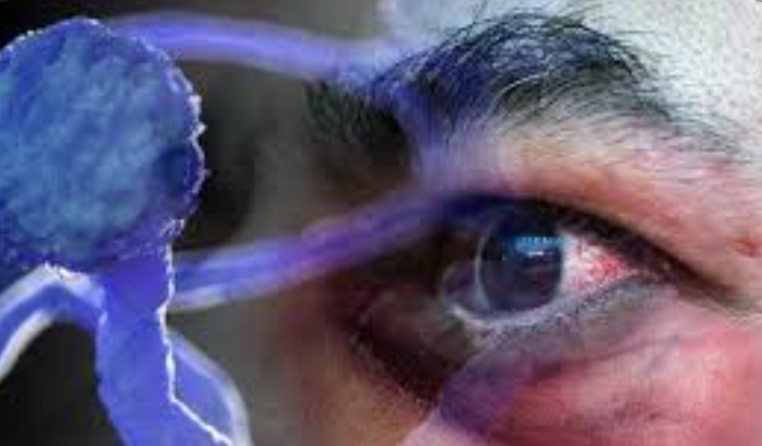 Secretaría de Salud confirma primer caso sospechoso de hongo negro en el país