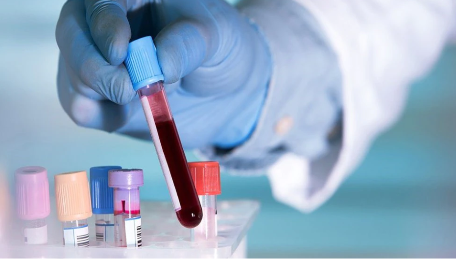 Un nuevo test de sangre permite detectar de forma temprana 50 tipos de cáncer