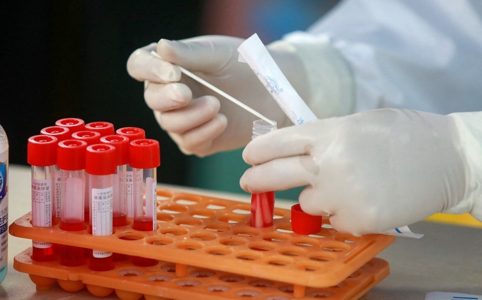 Medicamento para tratar los niveles de colesterol puede reducir hasta  un 70% la infección por COVID-19