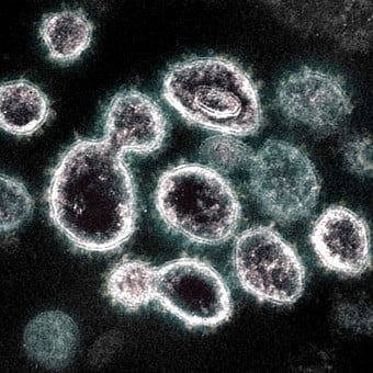 Detectan en Italia la variante AY.4.2 del coronavirus, más contagiosa que la Delta Detectan en Italia la variante AY.4.2 del coronavirus, más contagiosa que la Delta