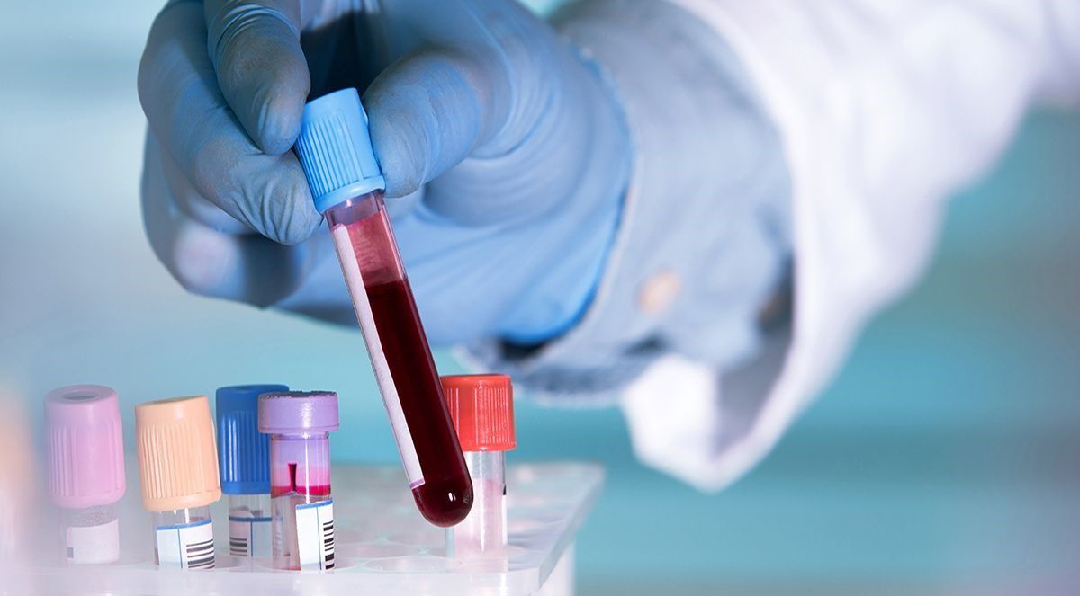 Solo con una gota de sangre un prometedor test permite la detección temprana de 50 tipos de cáncer Solo con una gota de sangre un prometedor test permite la detección temprana de 50 tipos de cáncer
