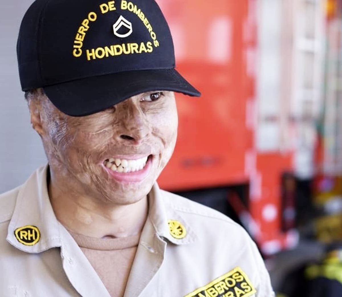 Bombero sobreviviente de «La Montañita» denuncia que por exigir cirugías prometidas, amenazan con despedirlo Bombero sobreviviente de «La Montañita» denuncia que por exigir cirugías prometidas, amenazan con despedirlo