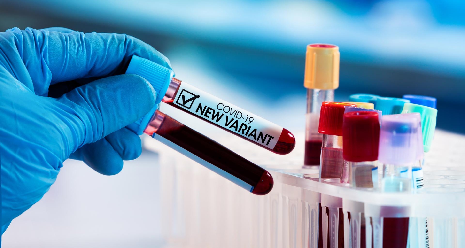 Ómicron: confirman los primeros casos de la nueva variante del coronavirus en América Latina Ómicron: confirman los primeros casos de la nueva variante del coronavirus en América Latina