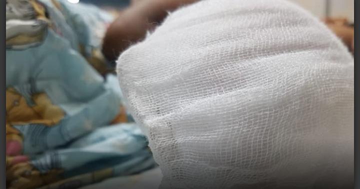 Un menor de seis años pierde su mano por manipular pólvora