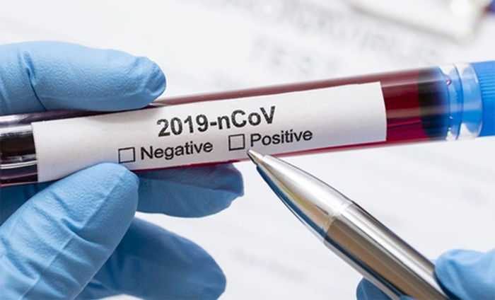 Había 17 casos de COVID-19, uno de ómicron, en barco llegado a Nueva Orleans