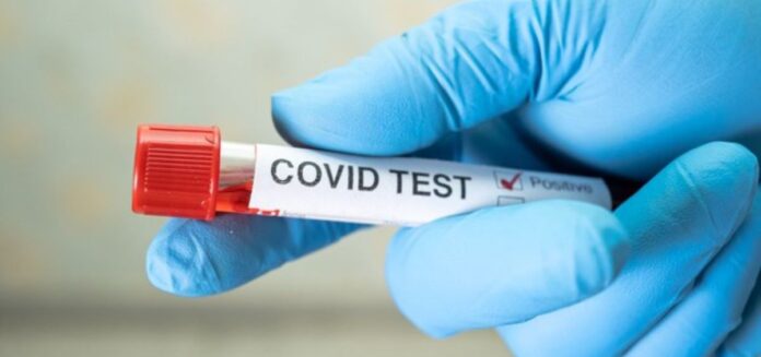 Honduras acumula a la fecha 378 mil 994 casos de COVID-19 Honduras acumula a la fecha 378 mil 994 casos de COVID-19