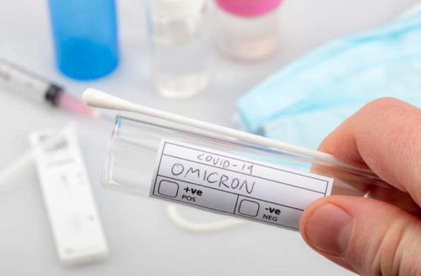 Honduras envía 75 muestras a laboratorio de Panamá para descartar variante Ómicron