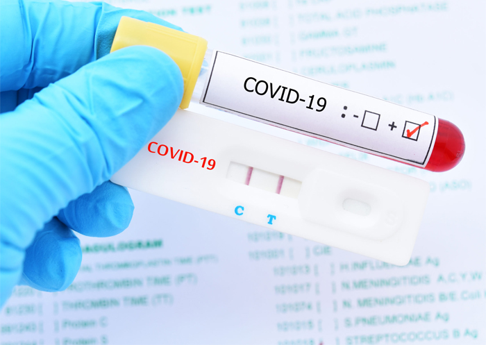 Investigador hondureño: 100% ha incrementado la positividad de COVID-19 en los últimos tres meses