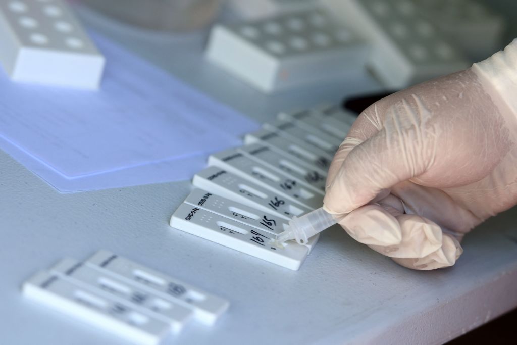 Brasil anuncia la primera muerte relacionada con ómicron Brasil anuncia la primera muerte relacionada con ómicron