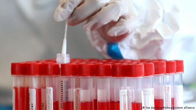 Científicos chinos presentan nuevo test de covid “ultrarrápido y preciso” Científicos chinos presentan nuevo test de covid “ultrarrápido y preciso”