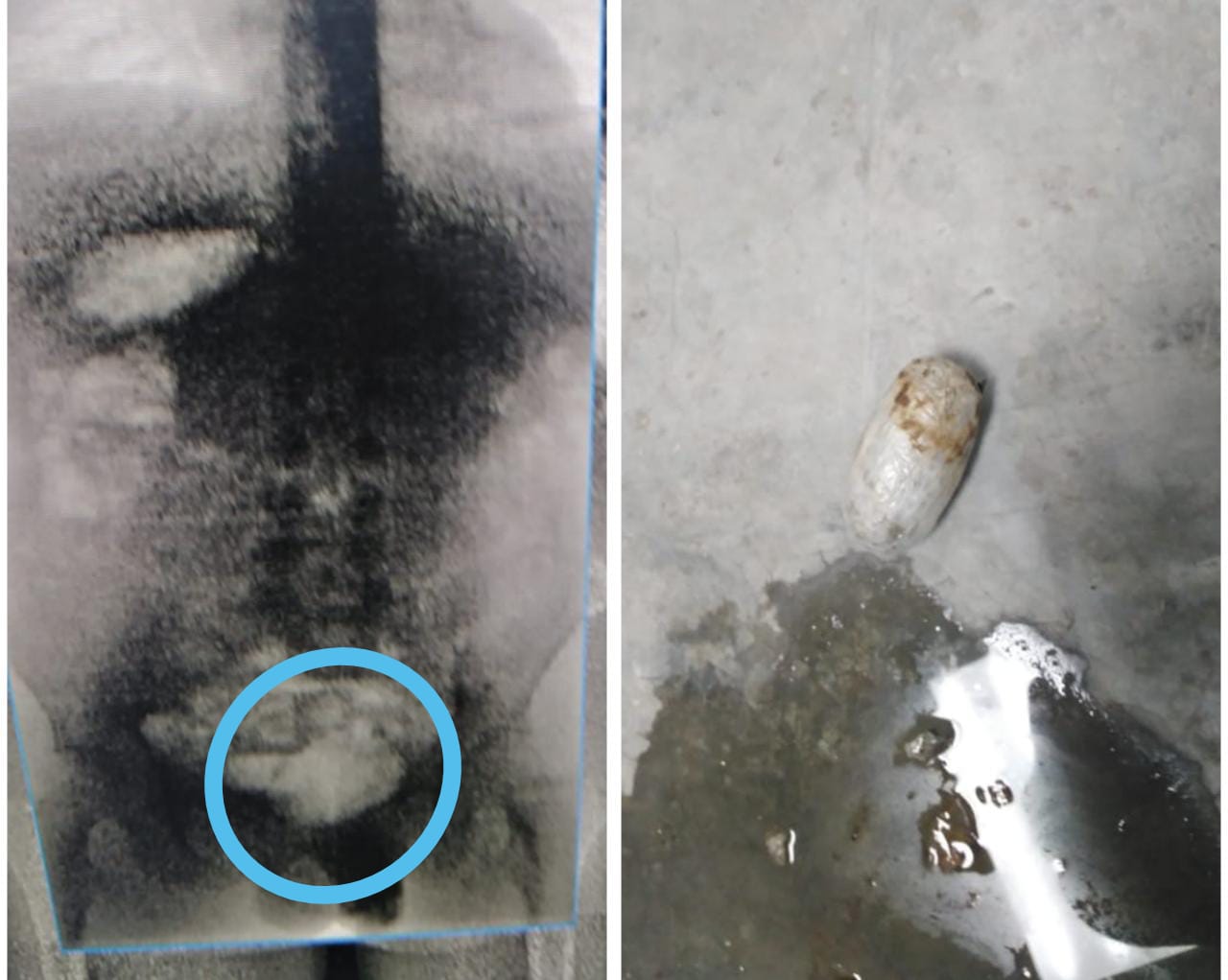 Recluso que regresaba a cárcel de El Paraíso pretendió introducir droga en sus partes intimas