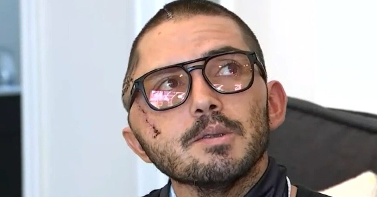 Colombiano sobrevivió ataque de un caimán Colombiano sobrevivió ataque de un caimán