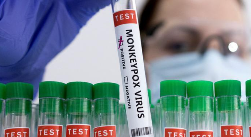 OMS ve signos «esperanzadores» de retroceso de viruela del mono en Europa