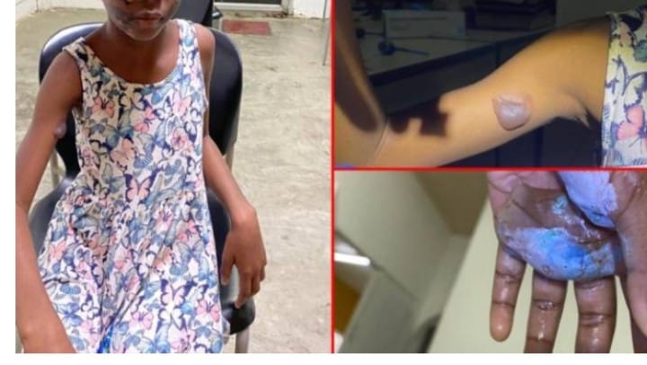 Madre castiga a su hija y le lanza agua caliente. Madre castiga a su hija y le lanza agua caliente.