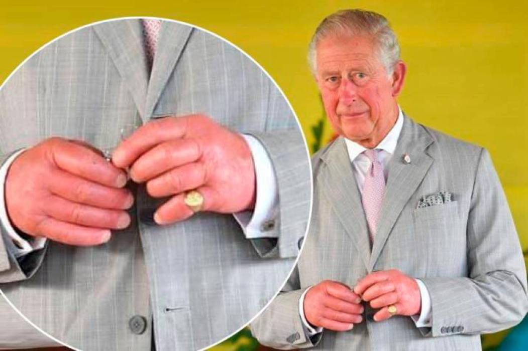 Conozca más sobre él Rey Carlos III y sus “Dedos de Salchicha “