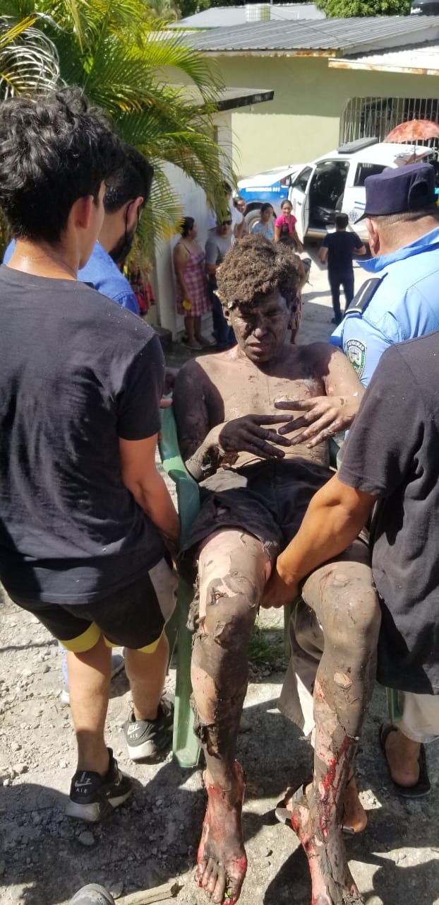 Dos muertos y cuatro heridos deja explosión en bodega de pólvora en Copán