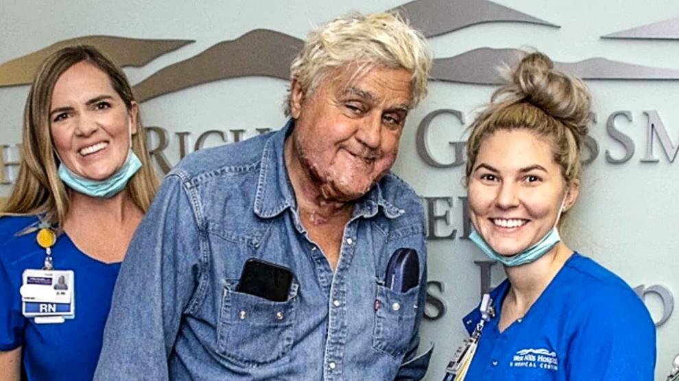 Jay Leno mostró por primera vez las marcas en su rostro luego de ser dado de alta tras la explosión que le provocó quemaduras. Jay Leno mostró por primera vez las marcas en su rostro luego de ser dado de alta tras la explosión que le provocó quemaduras.