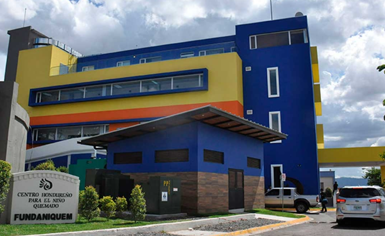 Ingresa menor de 10 años quemado por pólvora en el Hospital Escuela