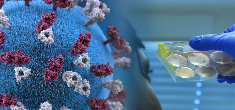 Casos de COVID-19 en el mundo siguen en aumento