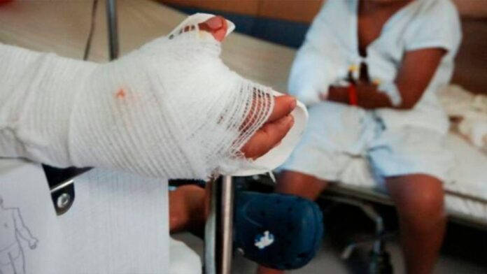 35 quemados por pólvora en temporada de navideña