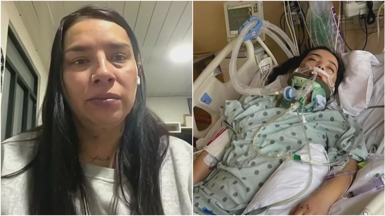 Joven sufre grave accidente en EEUU: su madre en Colombia pide visa humanitaria para poder verla Joven sufre grave accidente en EEUU: su madre en Colombia pide visa humanitaria para poder verla