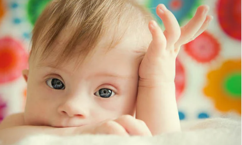 Día Mundial del Síndrome de Down: ¿Por qué se celebra este día? Día Mundial del Síndrome de Down: ¿Por qué se celebra este día?